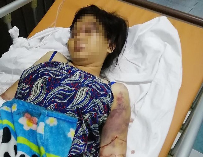 Diễn biến tố tụng mới vụ cô gái 18 tuổi bị đánh đến sẩy thai