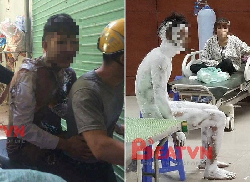 Công an thông tin vụ thanh niên tự thiêu vì bạn gái - ảnh 1