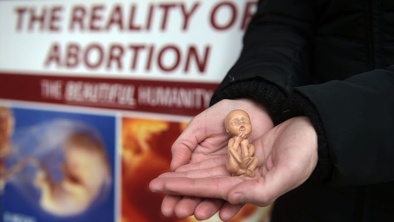 Một bang của Mỹ ra dự luật cấm phá thai khi phát hiện nhịp tim - ảnh 1