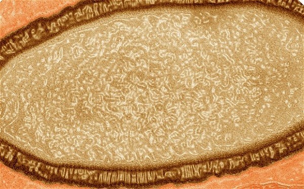 Trái đất nóng lên làm nhiều virus giết người sống lại - ảnh 3