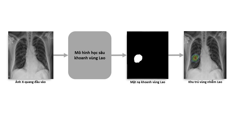 VinBrain phát hành sách trắng về ứng dụng AI chẩn đoán bệnh lao - ảnh 2