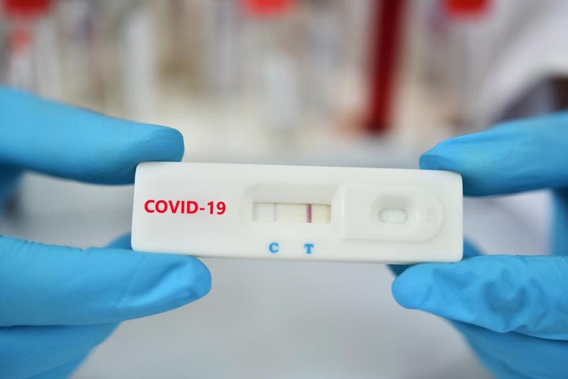 TP.HCM: Cơ sở khám chữa bệnh triển khai test nhanh SARS-CoV-2 - ảnh 1