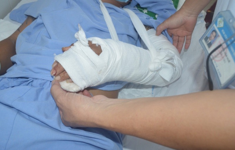Các bác sĩ Cần Thơ nối liền bàn tay trái đứt lìa cho bệnh nhân ở An Giang - ảnh 1