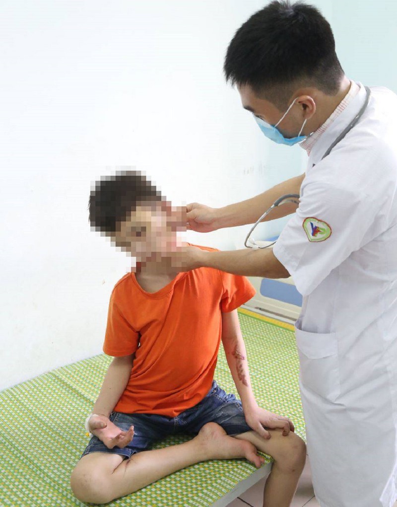 Vụ chủ quán bánh xèo hành hạ trẻ: Cục Trẻ em yêu cầu xử nghiêm - ảnh 2