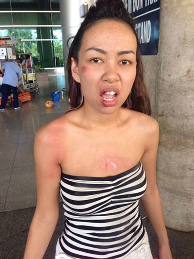 Thực hư nghệ sĩ bị cướp - ảnh 1