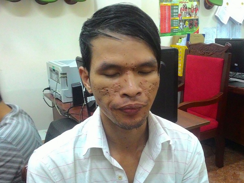 Bắt thêm người liên quan vụ Dũng Cam bạo hành trẻ em - ảnh 1