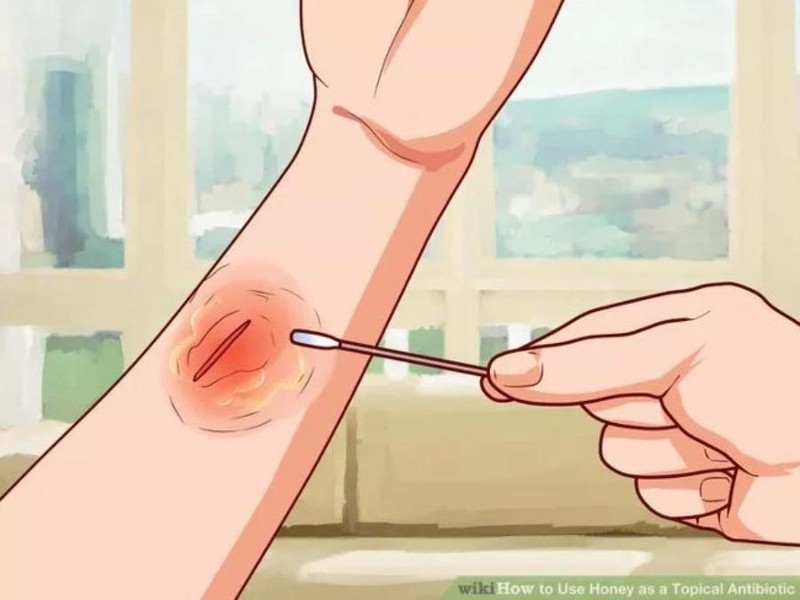 Muốn mau lành vết thương, chế độ dinh dưỡng ra sao? - ảnh 1