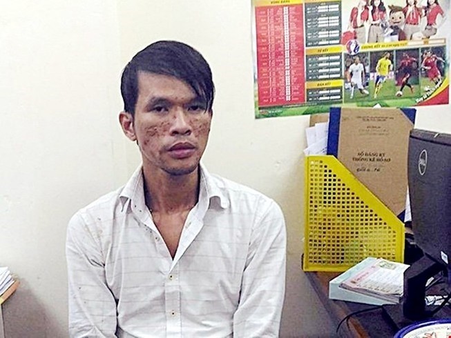 Dũng 'cam', kẻ hành hạ trẻ em gây chấn động đã chết - ảnh 1