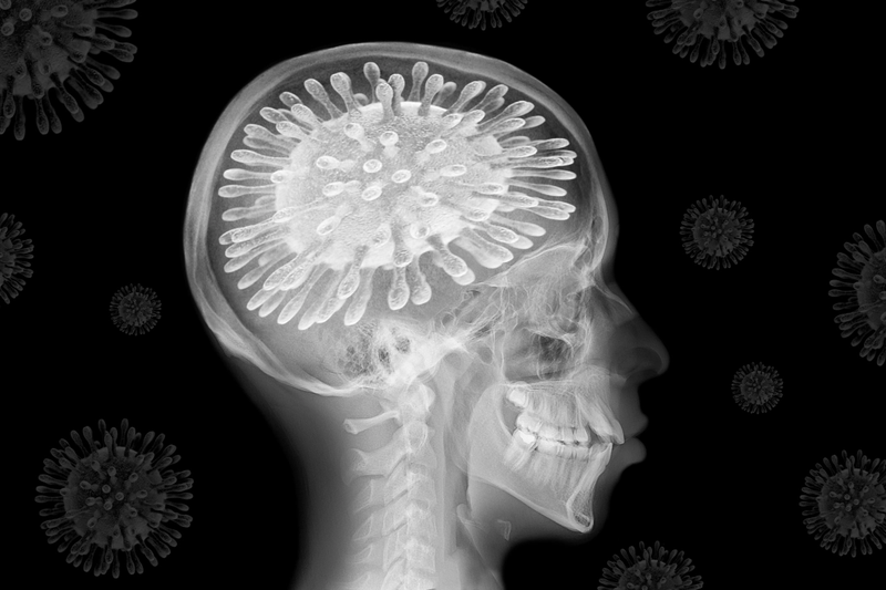 Chứng sương mù não: Virus SARS-CoV-2 đã làm gì với não bộ bệnh nhân COVID-19? - ảnh 1