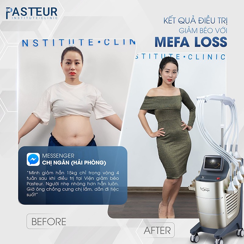 Có nên sử dụng dịch vụ tại Viện giảm béo Pasteur? - ảnh 2