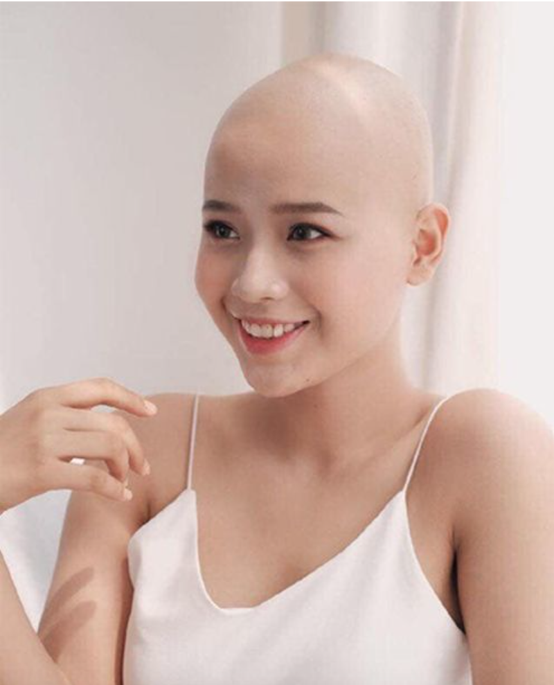 Nữ sinh Ngoại thương chiến thắng ung thư thi Miss World Vietnam - ảnh 1