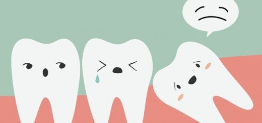 Tất cả những điều bạn cần biết về răng khôn