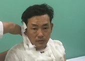 Thanh niên cướp ngân hàng ở Bình Tân gây án như thế nào