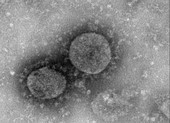 Hong Kong chế tạo được vaccine ngừa virus corona