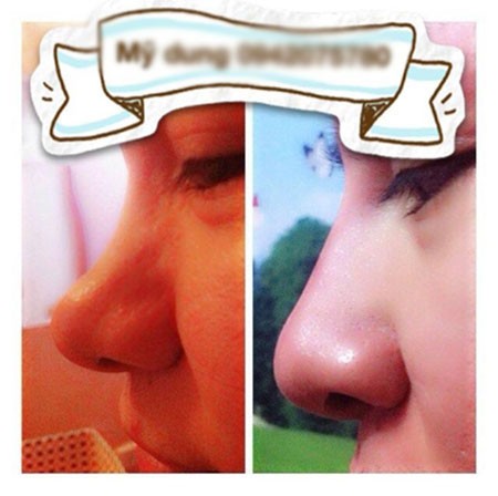 Hoảng hồn dịch vụ tiêm “thần dược” làm đẹp chui tại Hà Nội 1 Hoảng hồn dịch vụ tiêm “thần dược” làm đẹp chui tại Hà Nội 1