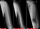 Người phụ nữ mắc bệnh cực hiếm, thế giới chỉ có 64 ca