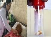 Hi hữu cụ ông gặp nguy vì hóc hạt mít