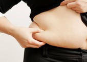 Béo bụng sẽ làm tăng nguy cơ đau tim?