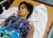 Diễn biến tố tụng mới vụ cô gái 18 tuổi bị đánh đến sẩy thai