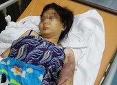 Truy tố 3 người tra tấn cô gái đến sẩy thai ở Bình Chánh